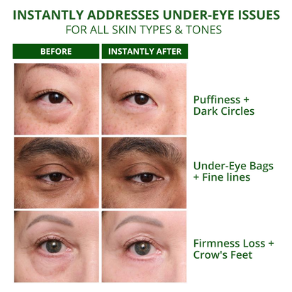 Temporary Under-Eye Tightening Cream