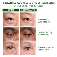 Temporary Under-Eye Tightening Cream