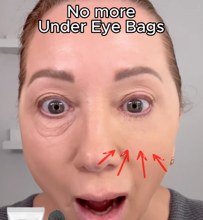 Temporary Under-Eye Tightening Cream