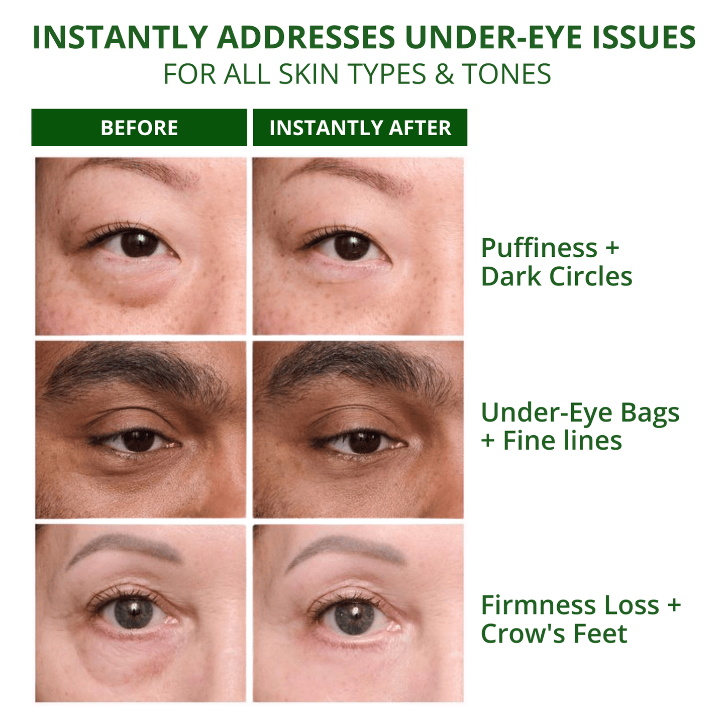 Temporary Under - Eye Tightening Cream - Fuzed